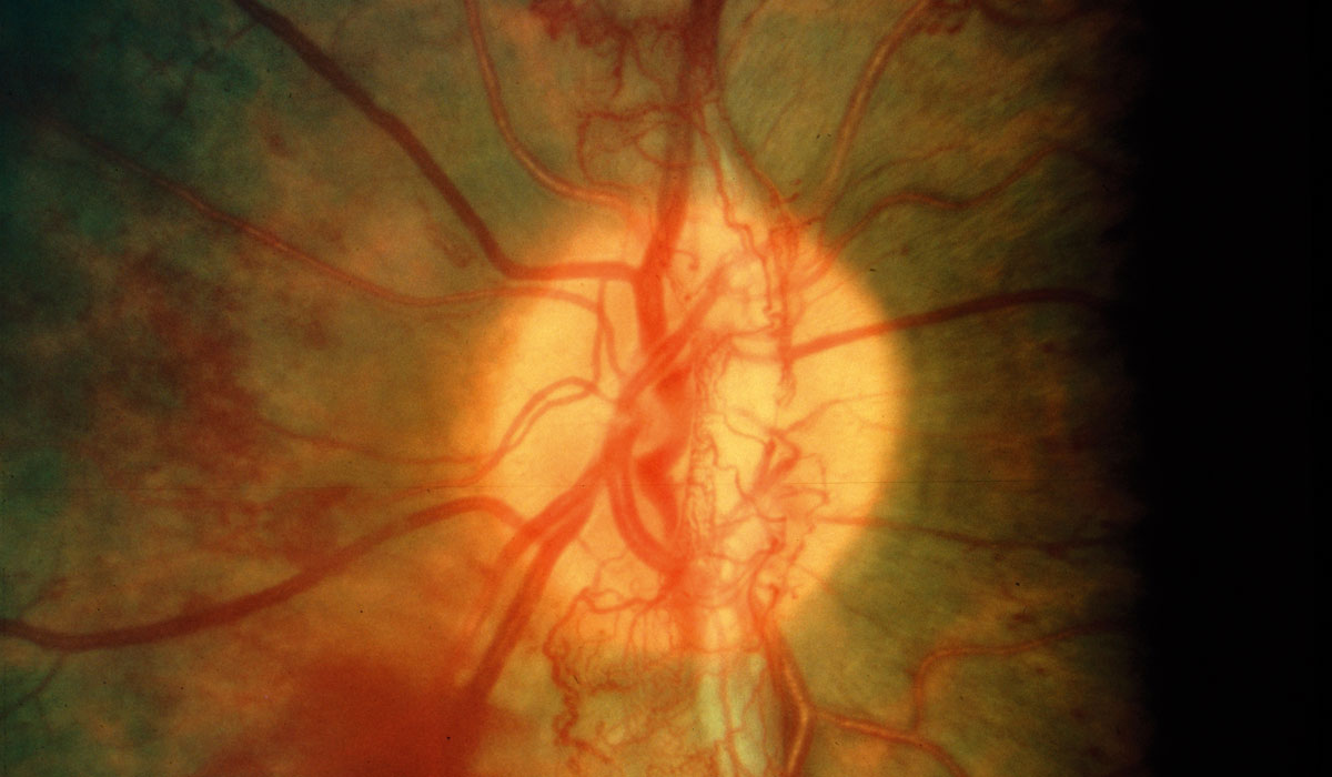 Hyperspectral Retinal Imaging with Smartphones