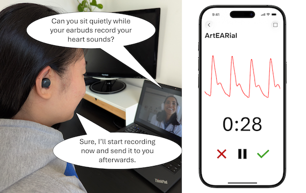 ArtEARial: Arterial Pressure Waveform Reconstruction Using Earbud Audio